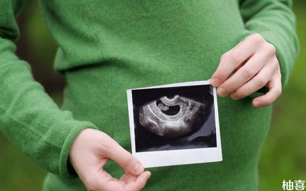 胎儿双肾盂扩张是不是将要生男孩的表现？