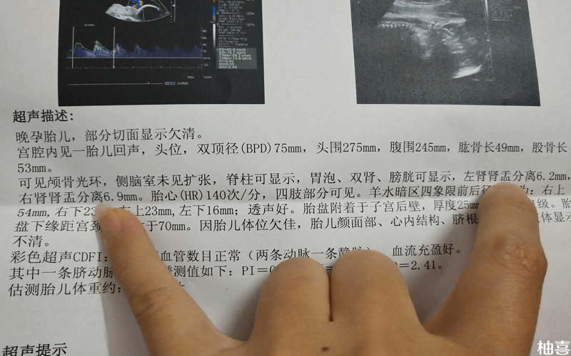 四维检查报告单