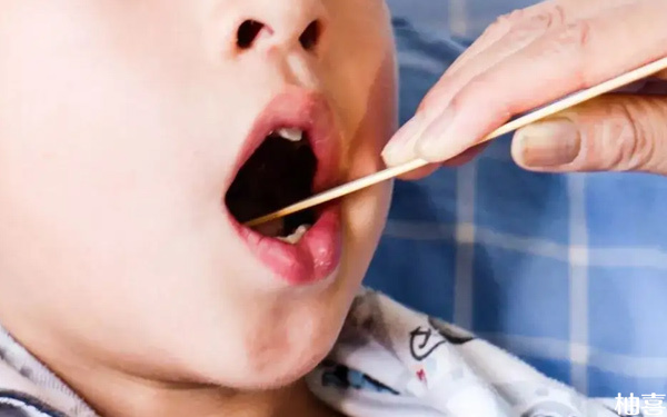 判断孩子舌系带短不短有技巧，利用临床症状表现可知晓
