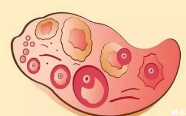 取一个卵泡做试管婴儿能培育出几个胚胎？