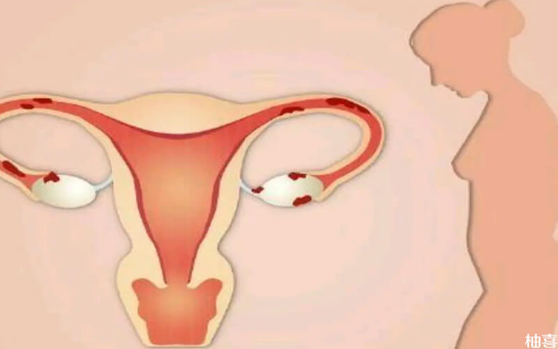 女性的子宫卵巢图片