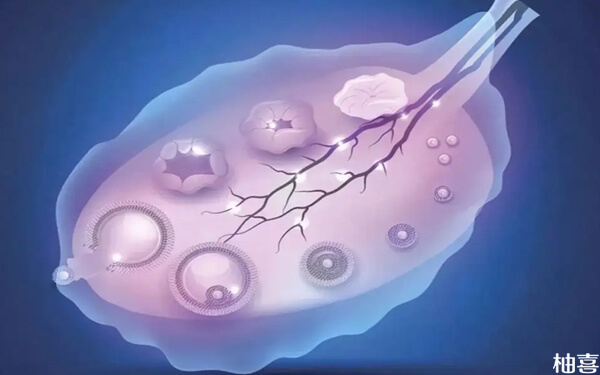 双侧卵巢共18个卵泡是正常情况还是算多囊？