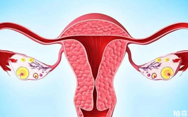 左右卵巢总共有19个窦卵泡是属于多囊卵巢吗?