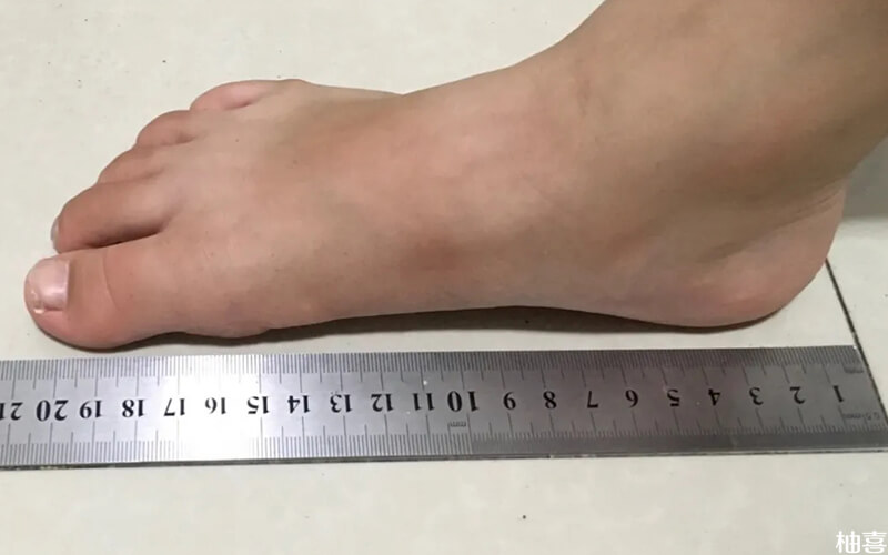 脚长测量