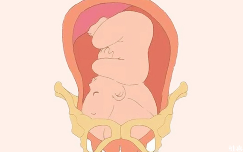 胎儿头位高示意图
