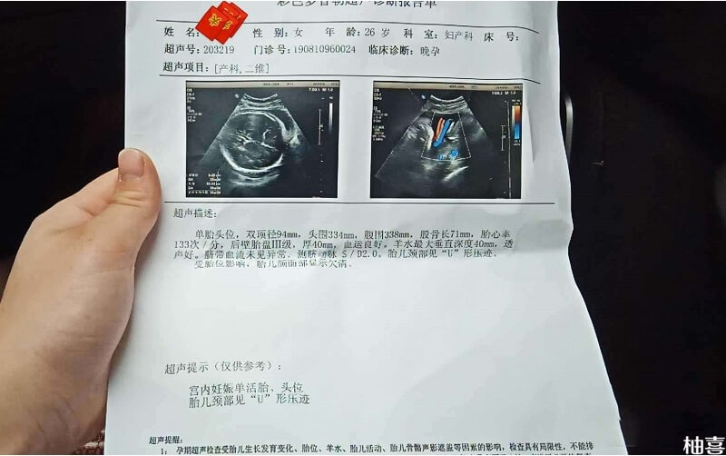 怀孕36周宝宝体重5斤是正常情况
