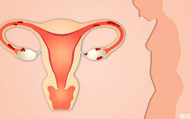 胚胎移植当天子宫内膜出现蠕动