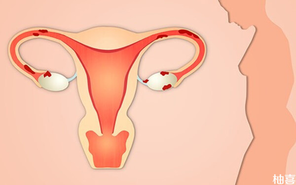 移植前子宫内膜双向蠕动活跃是好还是不好?