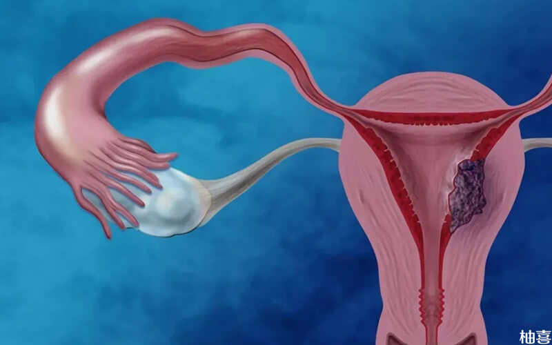 卵巢功能衰退是不可逆的过程
