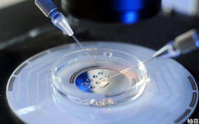 精子的DNA碎片化检查一般一周内就可出结果