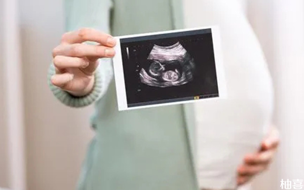 四维图像上胎儿横位是不是大多怀的都是男宝?