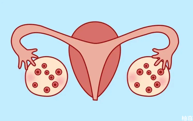 多囊卵巢会影响女性怀孕