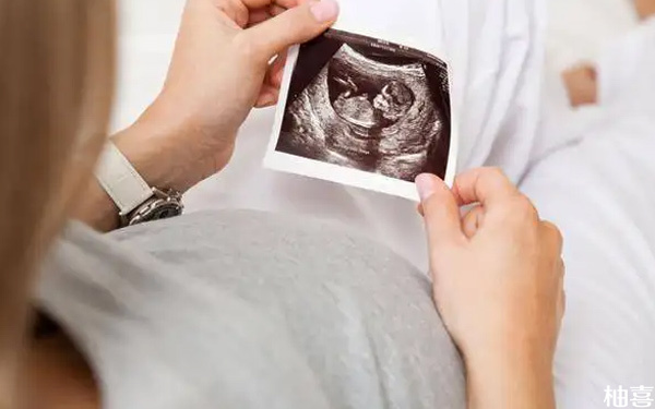 孕12周第一次产检指南分享！4大必查项目时间要正确