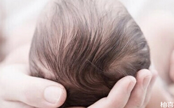 婴儿掉头发未必不正常！缺钙不只是唯一的原因