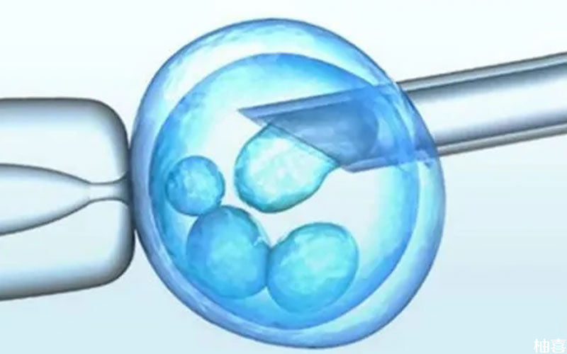 取卵19个一个胚胎都没有顺利培育成功