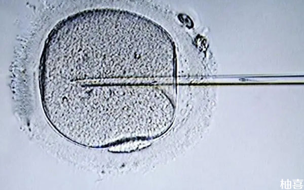 取卵27个没有出现腹水能安排在当月移植鲜胚吗？