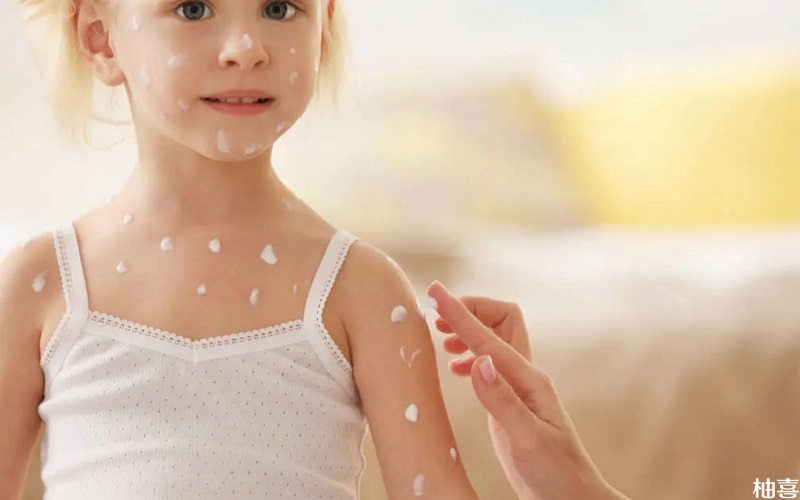 护臀霜对预防湿疹有一定的功效