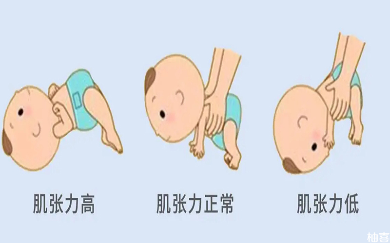 脑瘫宝宝表现出肌张力异常症状