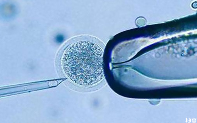 胚胎4细胞移植成功率比较小