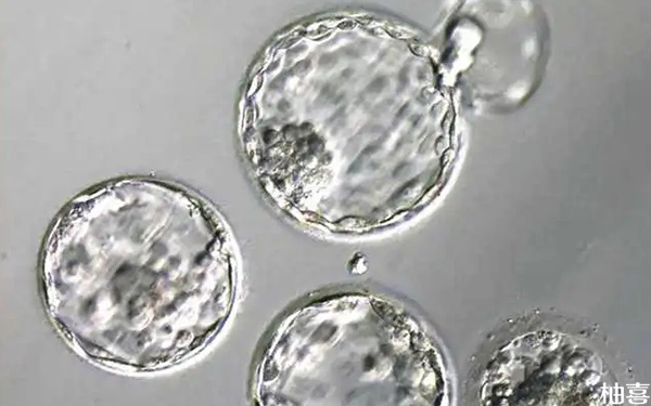 马赛克胚胎移植着床后成功生下健康宝宝的几率高不高?