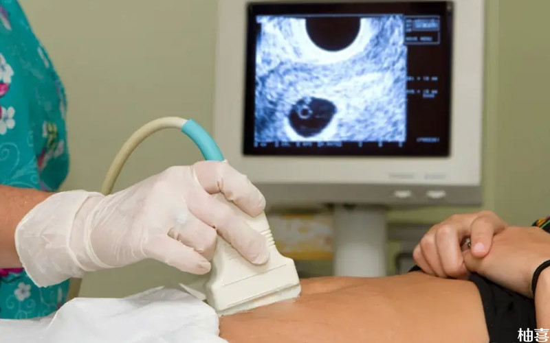 女性试管促排期间要随时监测卵泡发育