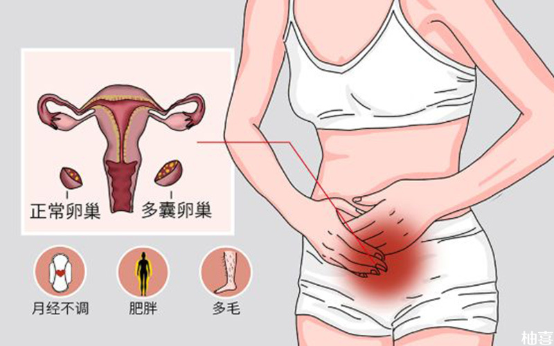 导致多囊女性提前排卵的因素有很多
