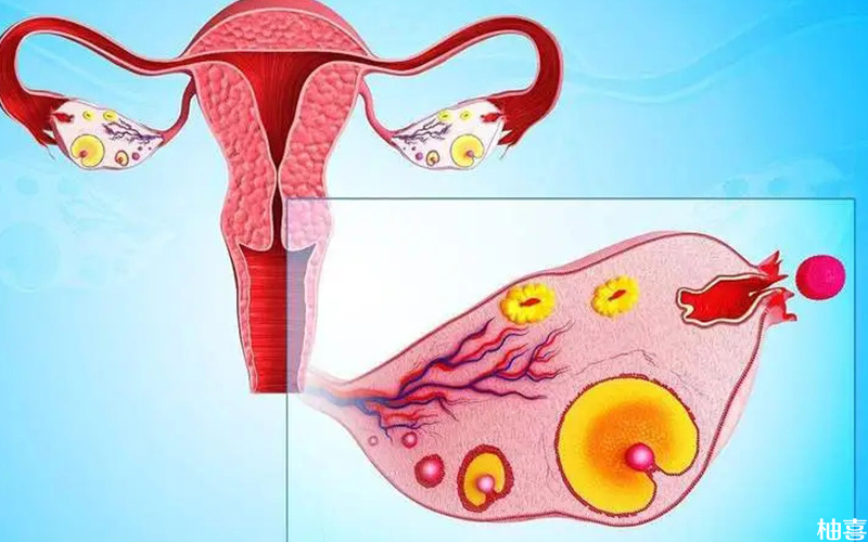 多囊患者属于卵巢高反应人群