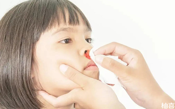 小孩子一到夏季就隔三差五突然流鼻血什么原因?