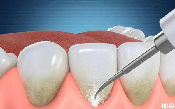 哺乳期牙龈发炎肿痛可以牙科洗牙吗?