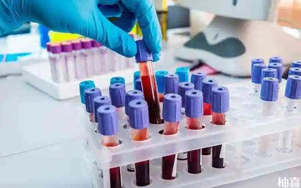 怀孕8周香港DNA验血检测到有y一定是生男孩吗?