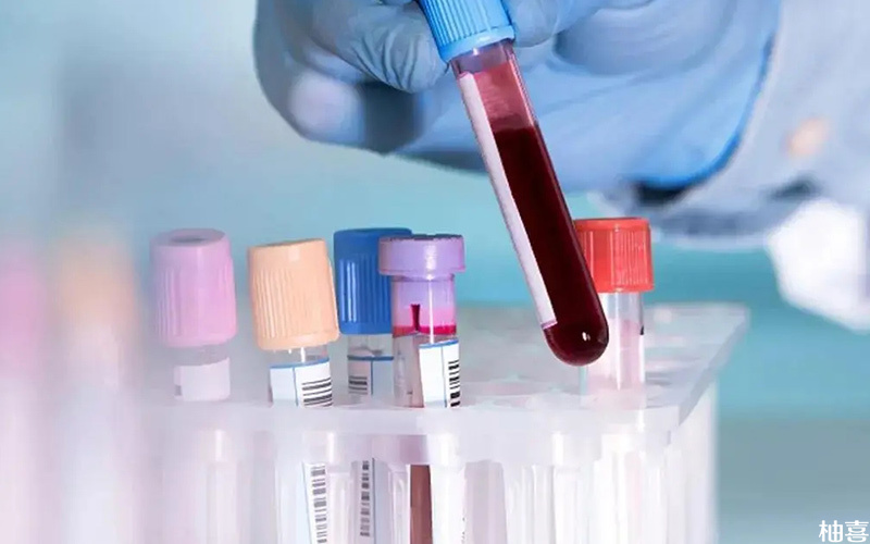 香港DNA验血可以查看胎儿性别