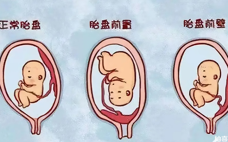 胎盘位置跟胎儿性别无关