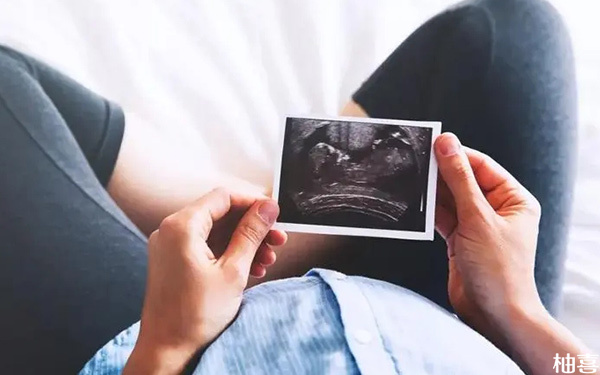 怀孕16周b超单子数据看男女的准确率是多少?