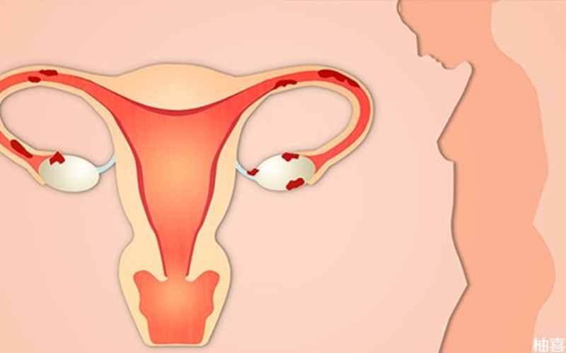 移植后腹水严重会影响胚胎发育