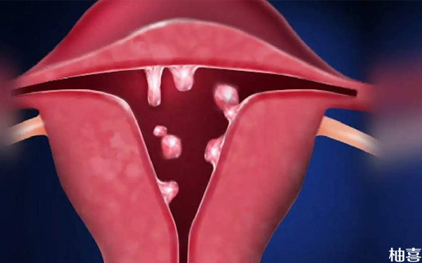 试管移植前B超见子宫内膜蠕动波活跃医生会怎么处理?