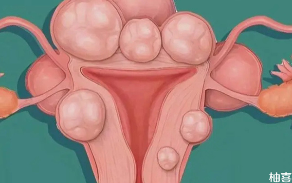 多囊卵巢不来月经可以不治疗直接准备促排吗?