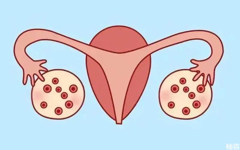 多囊卵巢不来月经建议先治疗
