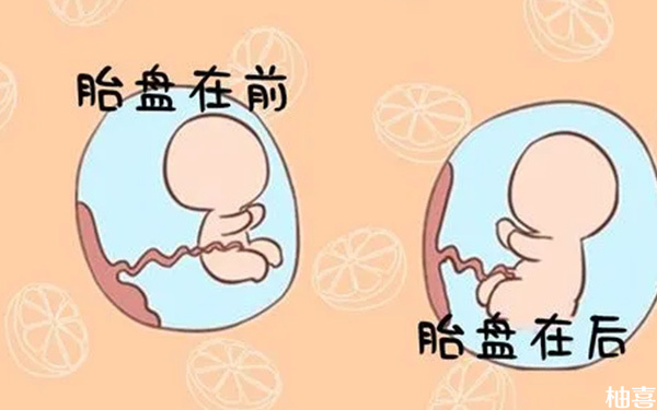 试管婴儿孕晚期是不是比自然怀孕更容易胎盘低置?