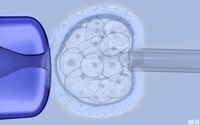 试管取出GV卵泡胚胎培养概率因人而异