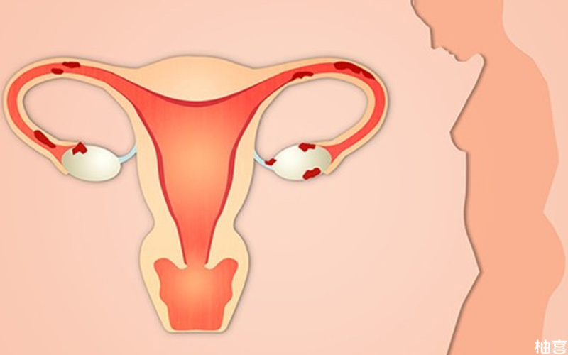女性子宫条件影响胚胎着床