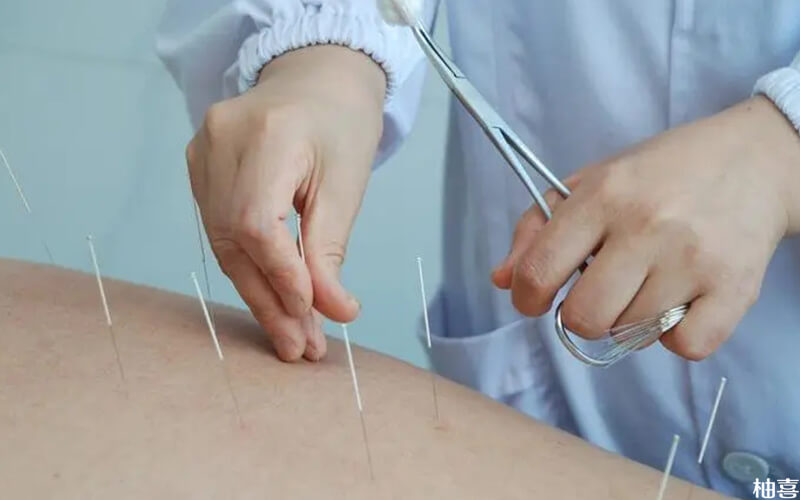 试管移植以前针灸可以调理身体