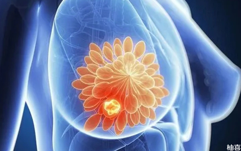 不合理使用促排激素药会促进乳腺癌发生