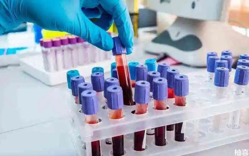 无创DNA检测需要提取母体外周血