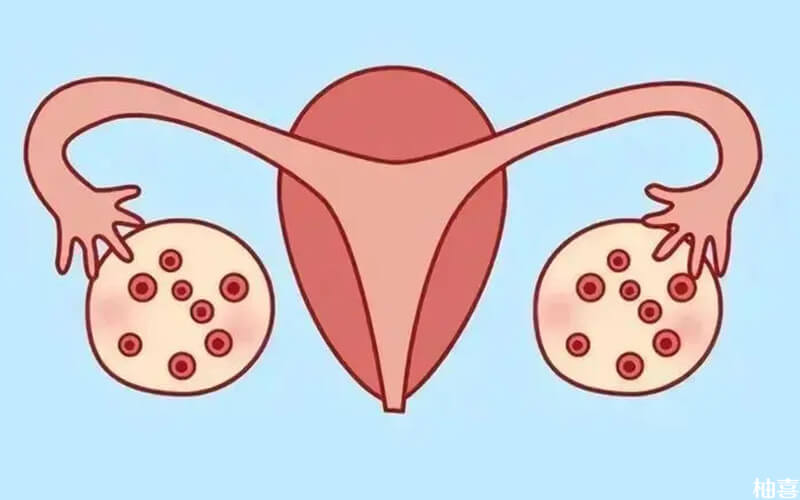 单侧窦卵泡12个以上是卵巢多囊样改变