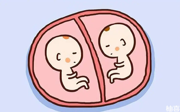 双胞胎在国家法律政策上算一胎还是算二胎呢?