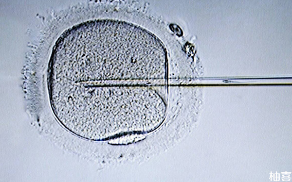 二代试管移植鲜胚还是囊胚好，成功率差别有多少？