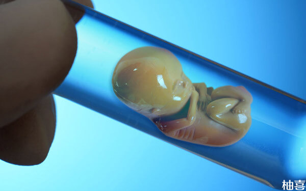 4cb冷冻囊胚解冻复苏后的质量一定比三天鲜胚二级好吗？