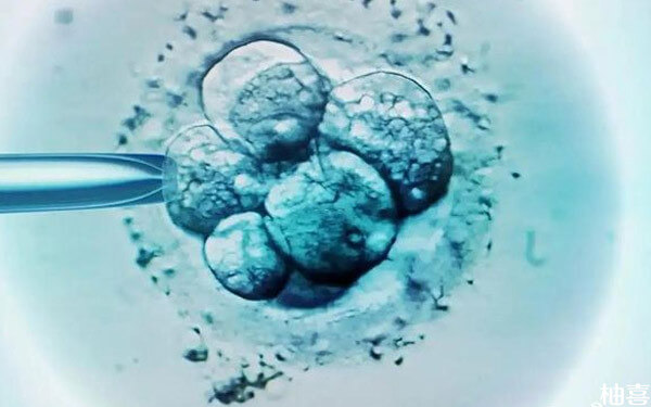 取卵33个成功率取决于胚胎数，多久移植还看卵巢恢复程度