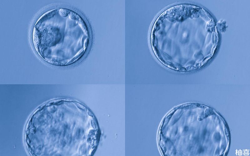 胚胎移植前需要养囊