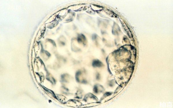 三代试管PGT检查染色体会破坏囊胚的什么组织？